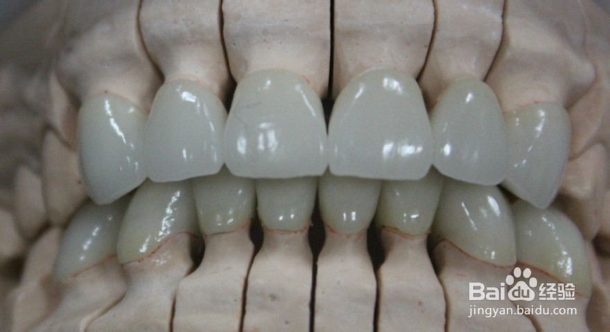取牙齿模型_牙齿取模型过程_取牙齿后注意事项
